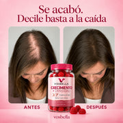 Antes y después de una mujer con menor caída y mayor densidad capilar junto a VOSBELLA para crecimiento de pelo